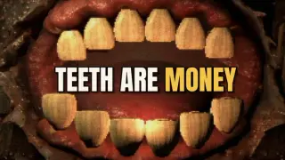 Teeth Are Money