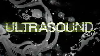 Ultrasound