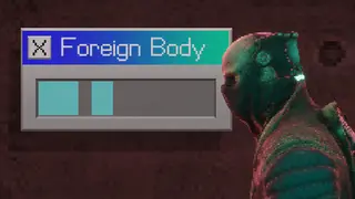 Foreign Body