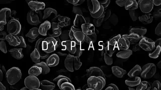 Dysplasia