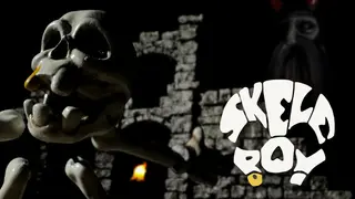 Skeleboy